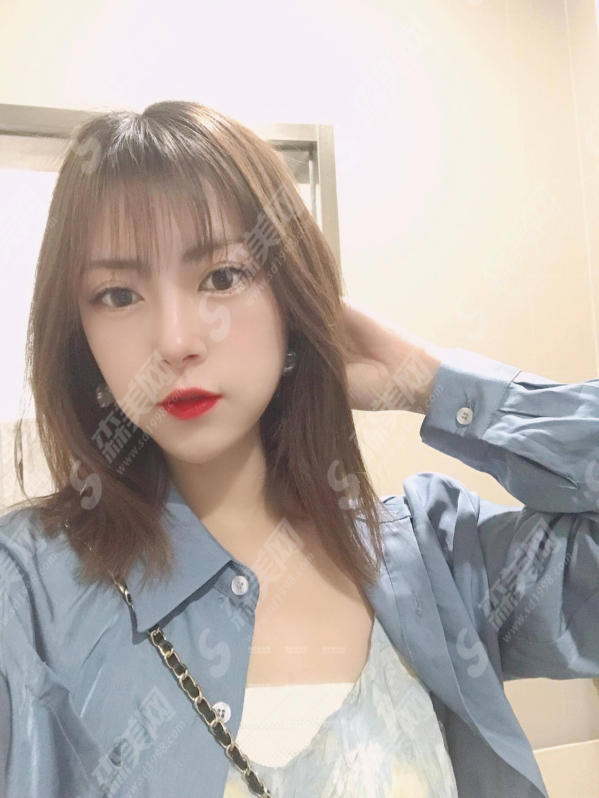 西安汉唐整形医院价目表2021,隆鼻技术怎么样?内附硅胶假体隆鼻的整形价目表