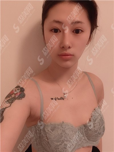 广州仁爱医院价目表2021,隆胸怎么样?内附新的假体隆胸的整形价目表