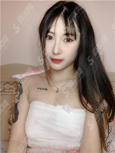 广州仁爱医院价目表2021,隆胸怎么样?内附新的假体隆胸的整形价目表