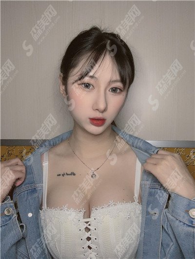 广州仁爱医院价目表2021,隆胸怎么样?内附新的假体隆胸的整形价目表