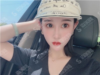 汕头星途整形医院价目表2021,眼修复整形怎么样？内附眼修复整形恢复果图