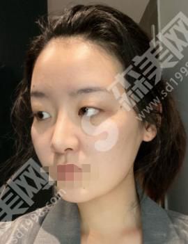 郑州集美整形医院做的整形果怎么样？附医师介绍及案例分享