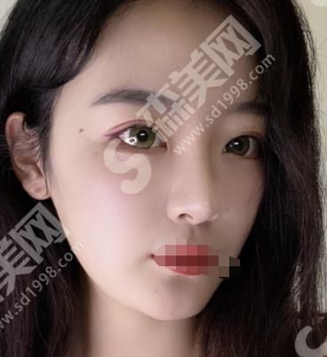 郑州集美整形医院做的整形果怎么样？附医师介绍及案例分享