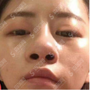 重庆大坪医院整形科鲁元刚医生鼻部手术技术好吗?附医院简介/医生介绍/案例分享/整形价目表2021