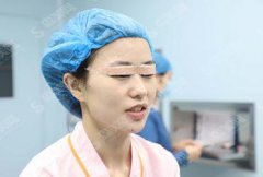 上海yestar整容是黑医院吗？找到了唐毅做双眼皮整形手术＋术后果分享