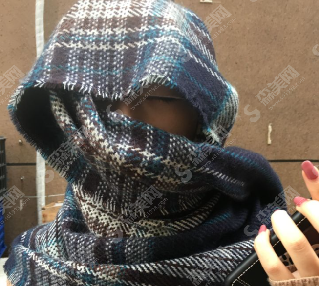 北京壹加壹医疗美容门诊部丁洪如医生做双眼皮技术怎么样?附医生简介及案例分享,2021较新价格