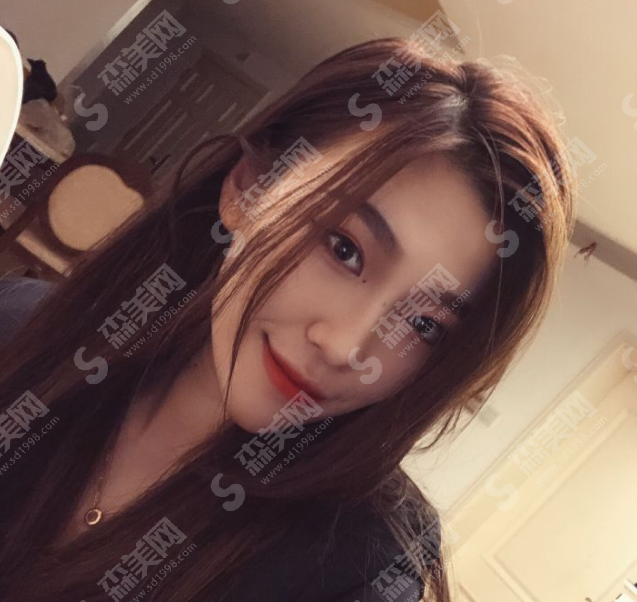 北京壹加壹医疗美容门诊部丁洪如医生做双眼皮技术怎么样?附医生简介及案例分享,2021较新价格