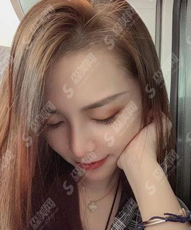 上海星氧整形美容医院隆鼻贵吗？内含肋软骨隆鼻详情分析及整形价目表