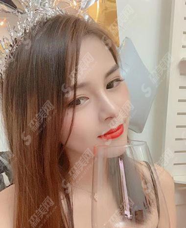 上海星氧整形美容医院隆鼻贵吗？内含肋软骨隆鼻详情分析及整形价目表