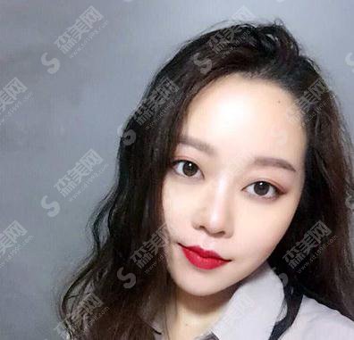 长沙派生医疗美容医院价目表2021，内含假体隆鼻真实案例详情对比