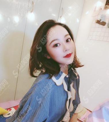 长沙派生医疗美容医院价目表2021，内含假体隆鼻真实案例详情对比