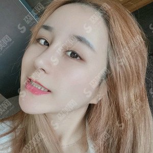 深圳医美整形隆鼻失败修复技术怎么样？内附隆鼻失败修复的康复对比图+较新整形价格