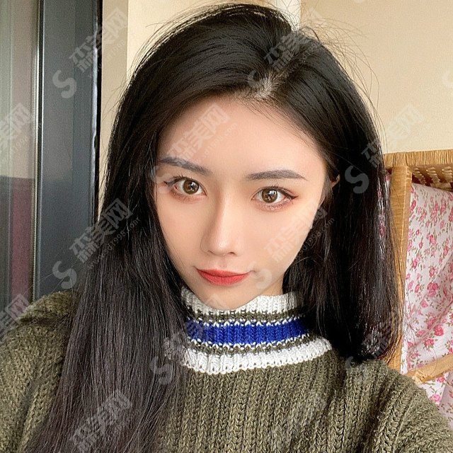 杭州格莱美整形价目表2021,内附面部埋线提升提升案例分享及术后果