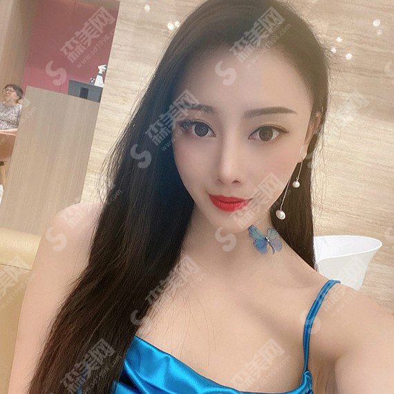 北京植发三甲医院中日友好医院价目表2021,中日友好医院植发技术怎么样?案例分享/医院简介