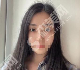 聊城韩美整形医院怎么样?医院医生有哪些?医院双眼皮案例前后对比图