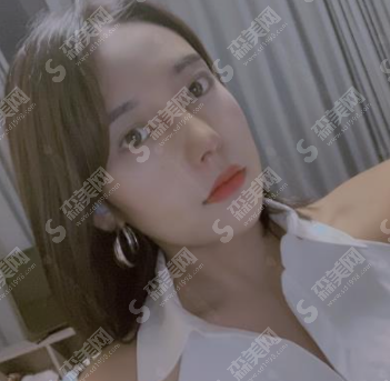 青岛赵宏武医疗美容诊所鼻部手术的果怎么样?附医生介绍/案例分享/隆鼻较新价格