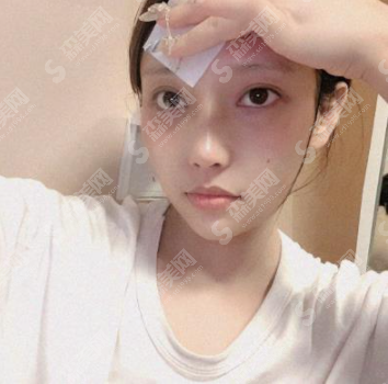 青岛赵宏武医疗美容诊所鼻部手术的果怎么样?附医生介绍/案例分享/隆鼻较新价格