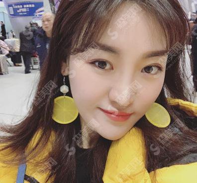 西京整形美容医院口碑好吗，内含面部埋线提升术后恢复详情