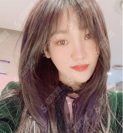 西京整形美容医院口碑好吗，内含面部埋线提升术后恢复详情