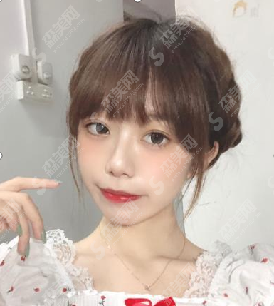 杭州星颜整形医院双眼皮果怎么样？亲述恢复日记+医院介绍+较新价格表