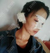 北京华韩医疗美容医院价目表2021,附耳软骨隆鼻详情对比图公布