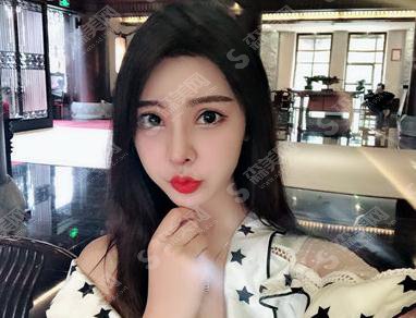 广州健丽医美价目表2021,内含鼻部手术术后恢复果对比