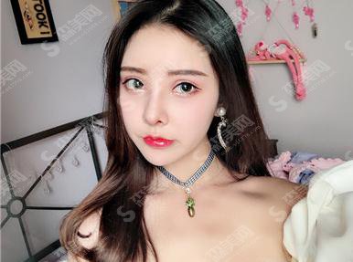 广州健丽医美价目表2021,内含鼻部手术术后恢复果对比