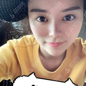 广西正规的整形医院有哪些?隆鼻整形价目表2021/案例分享/医院介绍