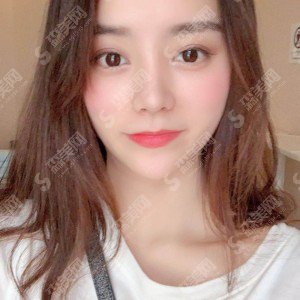 广西正规的整形医院有哪些?隆鼻整形价目表2021/案例分享/医院介绍