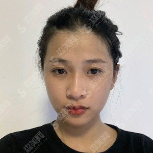 保定华美和蓝山哪个好?医院实力概况/案例分享