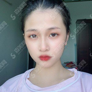 保定华美和蓝山哪个好?医院实力概况/案例分享