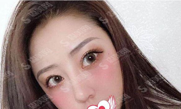 昆明吴氏嘉美整形和华美整形哪个好？实力对比＋案例展示