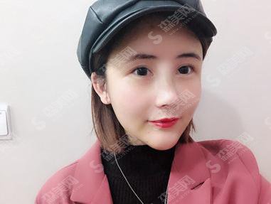 韩国korea整形医院靠谱吗?鼻部手术做的如何+术后恢复详情及整形价目表2021