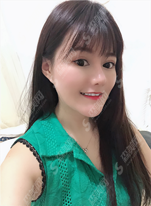 遵义医学院整形怎么样?遵义医学院磨骨手术恢复案例分享,附整形价目表2021