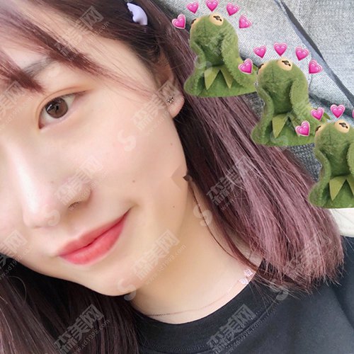 中山三院激光美肤价格表2021,内附激光美肤激光祛斑的治疗过程恢复图