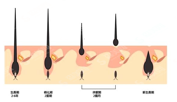 造成脱发的原因有哪些?植发的毛囊如何计算?附植发价目表2021