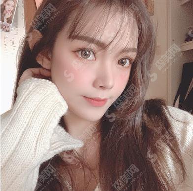 深圳北大双眼皮价目表2021，内含双眼皮整形案例＋术后恢复情况