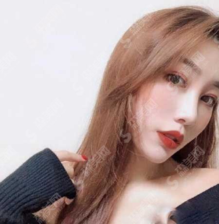 沈阳名流整形医院怎么样?面部填充注射案例分享/术后果/价目表2021