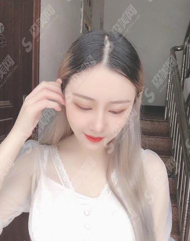 山东省立医院整形美容科价目表2021,内含鼻部手术术后恢复对比