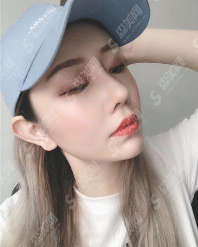 山东省立医院整形美容科价目表2021,内含鼻部手术术后恢复对比