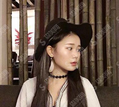 郑大一附院点阵激光多少钱?祛斑案例分享+详情恢复