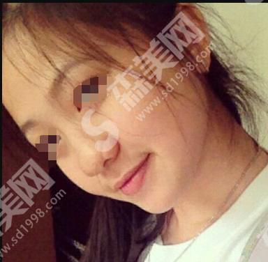 徐州四院周同葵的隆鼻技术怎么样？附医院介绍及医生介绍及案例分享