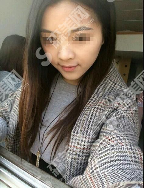 上海薇琳医院靠谱吗？内含医师介绍和鼻部整形案例分享