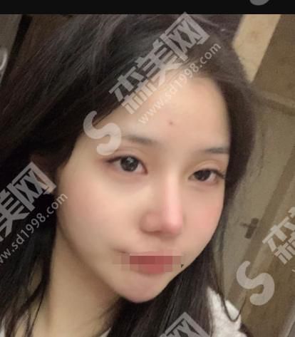 信阳中心医院医疗美容科胡媛媛医生怎么样？附医院介绍及医生介绍及案例