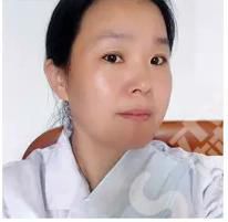 信阳中心医院医疗美容科胡媛媛医生怎么样？附医院介绍及医生介绍及案例