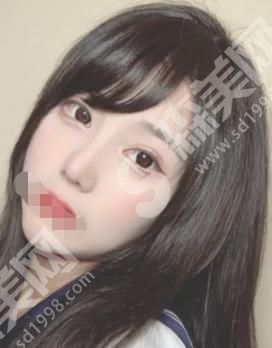 信阳中心医院医疗美容科胡媛媛医生怎么样？附医院介绍及医生介绍及案例