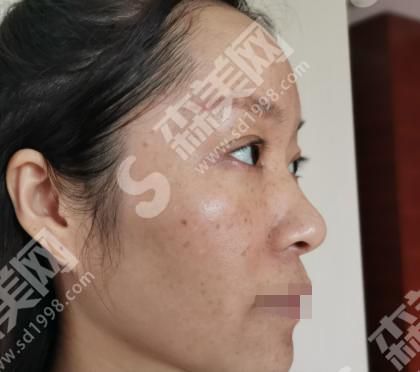 商丘华美医疗美容医院做的整形果如何？附医师介绍及案例分享