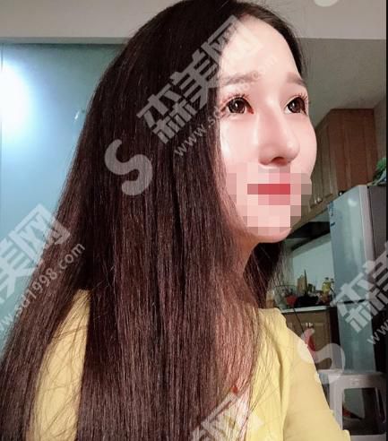 松原齐飞美容外科门诊部的整形怎么样？内含医师介绍及案例分享