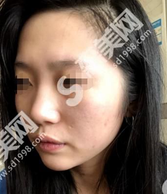 石家庄美联臣医院的医生实力大盘点!附医院介绍及案例分享