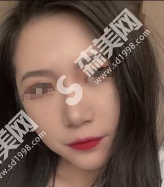 石家庄美联臣医院的医生实力大盘点!附医院介绍及案例分享